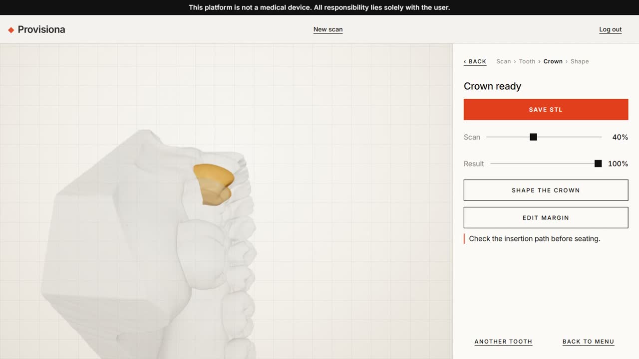 The crown generated on the selected tooth