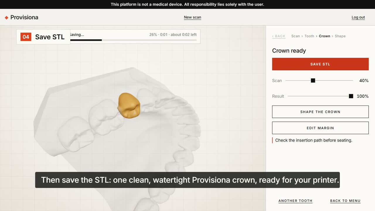 DeviCAD: a finished provisional crown on the scan, ready to save as STL