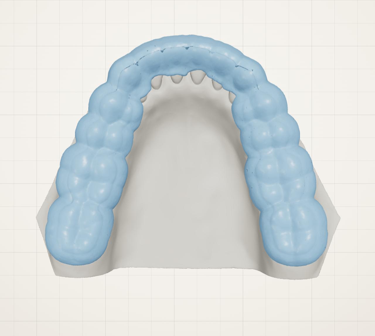 DeviCAD: a night guard built on the whole jaw of a dental model, seen from above